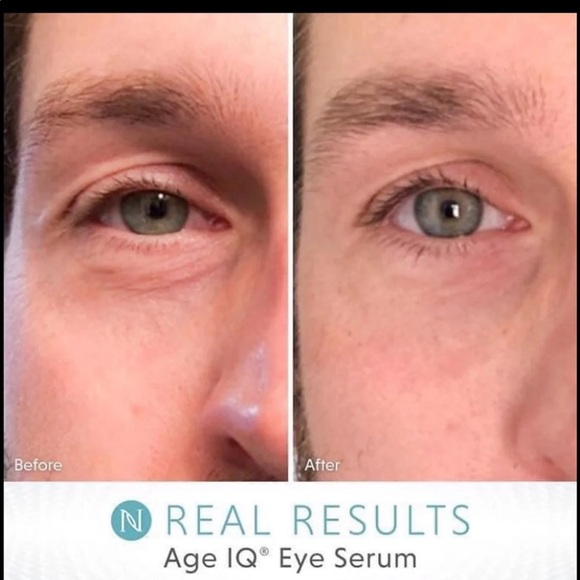 π Neora Age IQ Eye Serum - Picture 3 of 8